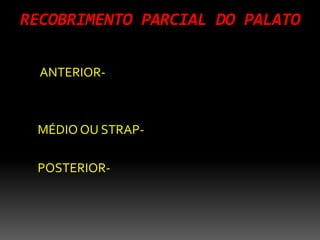 RECOBRIMENTO PARCIAL DO PALATO
ANTERIOR-
MÉDIO OU STRAP-
POSTERIOR-
 