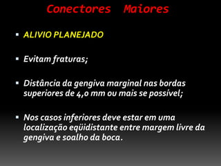 Conectores Maiores
 ALIVIO PLANEJADO
 Evitam fraturas;
 Distância da gengiva marginal nas bordas
superiores de 4,0 mm ou mais se possível;
 Nos casos inferiores deve estar em uma
localização eqüidistante entre margem livre da
gengiva e soalho da boca.
 