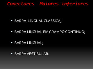 Conectores Maiores inferiores
 BARRA LÍNGUAL CLASSICA;
 BARRA LÍNGUAL EM GRAMPO CONTÍNUO;
 BARRA LÍNGUAL;
 BARRAVESTIBULAR.
 