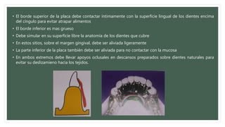 • El borde superior de la placa debe contactar íntimamente con la superficie lingual de los dientes encima
del cíngulo para evitar atrapar alimentos
• El borde inferior es mas grueso
• Debe simular en su superficie libre la anatomía de los dientes que cubre
• En estos sitios, sobre el margen gingival, debe ser aliviada ligeramente
• La parte inferior de la placa también debe ser aliviada para no contactar con la mucosa
• En ambos extremos debe llevar apoyos oclusales en descansos preparados sobre dientes naturales para
evitar su deslizamieno hacia los tejidos.
 
