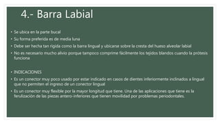 4.- Barra Labial
• Se ubica en la parte bucal
• Su forma preferida es de media luna
• Debe ser hecha tan rígida como la barra lingual y ubicarse sobre la cresta del hueso alveolar labial
• No es necesario mucho alivio porque tampoco comprime fácilmente los tejidos blandos cuando la prótesis
funciona
• INDICACIONES
• Es un conector muy poco usado por estar indicado en casos de dientes inferiormente inclinados a lingual
que no permiten el ingreso de un conector lingual
• Es un conector muy flexible por la mayor longitud que tiene. Una de las aplicaciones que tiene es la
ferulización de las piezas antero-inferiores que tienen movilidad por problemas periodontales.
 