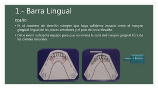 1.- Barra Lingual
DISEÑO
• Es el conector de elección siempre que haya suficiente espacio entre el margen
gingival lingual de las piezas anteriores y el piso de boca elevado.
• Debe existir suficiente espacio para que no invada la zona del margen gingival libre de
los dientes naturales
> 8 mm
 