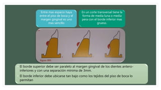 • El borde superior debe ser paralelo al margen gingival de los dientes antero-
inferiores y con una separación mínima de 3mm.
• El borde inferior debe ubicarse tan bajo como los tejidos del piso de boca lo
permitan
Entre mas espacio haya
entre el piso de boca y el
margen gingival es uno
mas sencillo
En un corte transversal tiene la
forma de media luna o media
pera con el borde inferior mas
grueso.
 