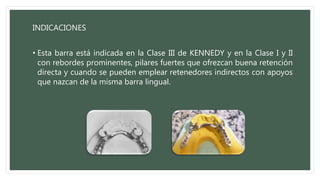 INDICACIONES
• Esta barra está indicada en la Clase III de KENNEDY y en la Clase I y II
con rebordes prominentes, pilares fuertes que ofrezcan buena retención
directa y cuando se pueden emplear retenedores indirectos con apoyos
que nazcan de la misma barra lingual.
 