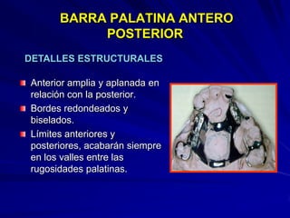 Conectores Mayores Y Apoyos