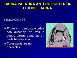 Conectores Mayores Y Apoyos