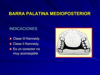 Conectores Mayores Y Apoyos