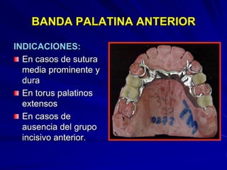 Conectores Mayores Y Apoyos