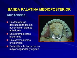 Conectores Mayores Y Apoyos