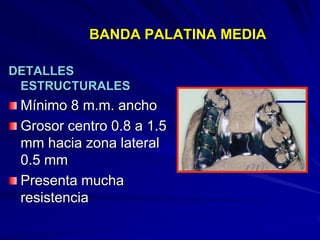 Conectores Mayores Y Apoyos