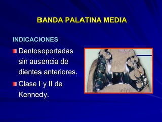 Conectores Mayores Y Apoyos