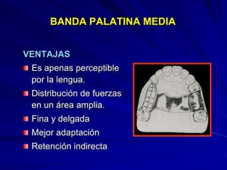 Conectores Mayores Y Apoyos