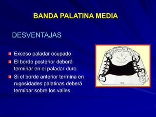 Conectores Mayores Y Apoyos