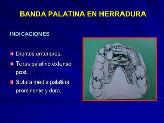 Conectores Mayores Y Apoyos