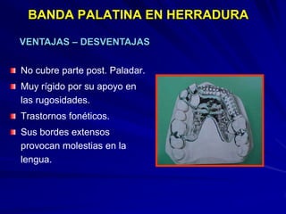 Conectores Mayores Y Apoyos