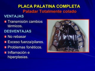 Conectores Mayores Y Apoyos