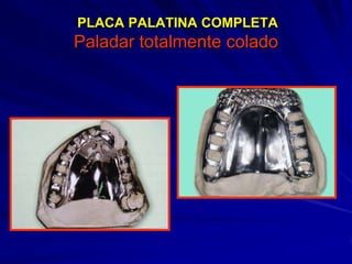 Conectores Mayores Y Apoyos