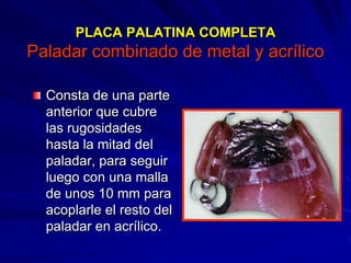 Conectores Mayores Y Apoyos