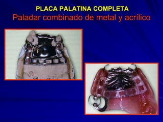 Conectores Mayores Y Apoyos