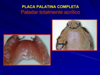 Conectores Mayores Y Apoyos