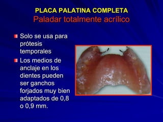 Conectores Mayores Y Apoyos