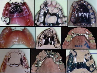 Conectores Mayores Y Apoyos