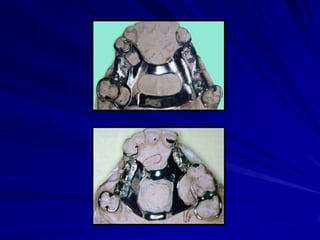 Conectores Mayores Y Apoyos