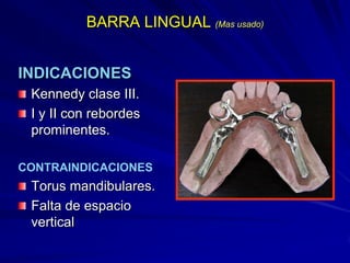 Conectores Mayores Y Apoyos