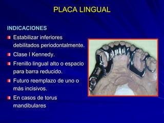 Conectores Mayores Y Apoyos