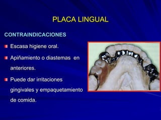 Conectores Mayores Y Apoyos