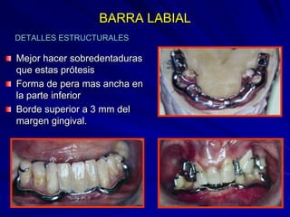 Conectores Mayores Y Apoyos