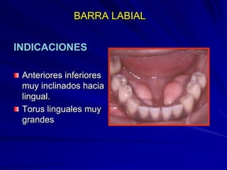 Conectores Mayores Y Apoyos