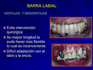 Conectores Mayores Y Apoyos