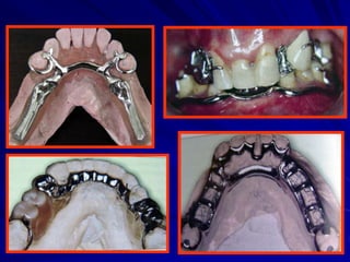 Conectores Mayores Y Apoyos