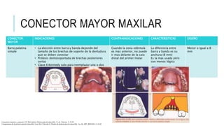 CONECTOR MAYOR MAXILAR
CONECTOR
MAYOR
INDICACIONES CONTRAINDICACIONES CARACTERISTICAS DISEÑO
Barra palatina
simple
• La elección entre barra y banda depende del
tamaño de las brechas de soporte de la dentadura
que se deben conectar
• Prótesis dentosoportada de brechas posteriores
cortas
• Clase II Kennedy solo para reemplazar una o dos
piezas
• Cuando la oclusión antagónica es débil (prótesis
total inferior)
Cuando la zona edéntula
es mas anterior, no puede
ir mas delante de la cara
distal del primer molar
La diferencia entre
barra y banda es su
anchura (8 mm)
Es la mas usada pero
con menos lógica
Menor o igual a 8
mm
Conectores mayores y menores. EN: McCracken, Prótesis parcial removible, 11 ed., Elsevier, 5, 35-65.
Componentes de la prótesis parcial removible. Loza D & Valverde H. Diseño de prótesis parcial removible. 1ra. Ed. 2007. RIPANO, 2, 16-92
 