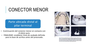 CONECTOR MENOR
Parte ubicada distal al
pilar terminal
• Continuación del conector menor en contacto con
el plano guía.
• FINALIDAD: establecer línea de acabado definida
para la base de acrílico antes del procesado.
 