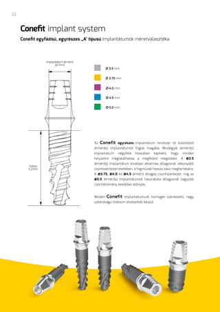 24
implantátum átmérő
(ø mm)
hossz
(L)mm
ø3.75 mm
ø3.5 mm
ø4.0 mm
ø3.62 mm
ø4.5 mm
ø5.0 mm
Conefit implant system
Conefit ...
