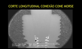 CORTE LONGITUDINAL CONEXÃO CONE MORSE
 