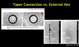 Taper Connection vs. External Hex
Boggan, et al. JPD, 1999.
 