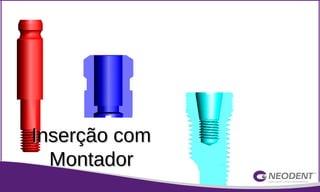 Inserção comInserção com
MontadorMontador
 