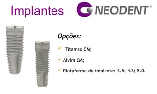 Implantes
Opções:
 Titamax CM;
 Alvim CM;
 Plataforma do implante: 3.5; 4.3; 5.0.
 