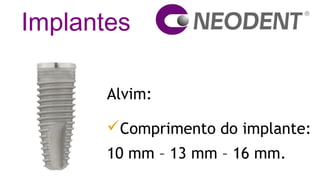 Implantes
Alvim:
Comprimento do implante:
10 mm – 13 mm – 16 mm.
 