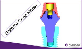 Sistem
a
Cone
M
orse
Sistem
a
Cone
M
orse
 