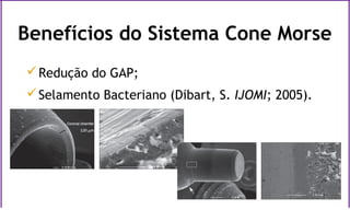 Redução do GAP;
Selamento Bacteriano (Dibart, S. IJOMI; 2005).
Benefícios do Sistema Cone Morse
 