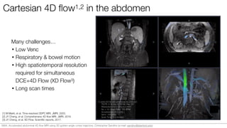 Cartesian 4D ﬂow1,2 in the abdomen
Many challenges…
• Low Venc
• Respiratory & bowel motion
• High spatiotemporal resolution
required for simultaneous
DCE+4D Flow (XD Flow3)
• Long scan times
11-year-old female patient w/ ferumoxytol
TE/TR: 2.16 ms / 6.16 ms; Flip: 20°
Resolution: 1.0 x 1.4 x 1.0 mm3
Nc = 10, Heart Rate: 100 BPM
Acceleration: 4.0 x 2.5
Venc: 100 cm/s
Scan Time: 9.4 minutes
[1] M Markl, et al. Time-resolved 3DPC MRI. JMRI, 2003.
[2] JY Cheng, et al. Comprehensive 4D ﬂow MRI. JMRI, 2016.
[3] JY Cheng, et al. XD Flow. Scientiﬁc reports, 2017.
0684. Accelerated abdominal 4D ﬂow MRI using 3D golden-angle cones trajectory. Christopher Sandino (e-mail: sandino@stanford.edu)
 