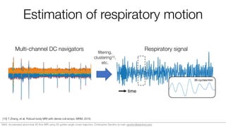 Estimation of respiratory motion
[10] T Zhang, et al. Robust body MRI with dense coil arrays. MRM, 2016.
Multi-channel DC navigators Respiratory signal
ﬁltering,
clustering10,
etc.
0684. Accelerated abdominal 4D ﬂow MRI using 3D golden-angle cones trajectory. Christopher Sandino (e-mail: sandino@stanford.edu)
 
