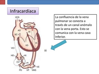 Infracardíaca
                La confluencia de la vena
                pulmonar se conecta a
                través de un canal anómalo
                con la vena porta. Esto se
                comunica con la vena cava
                Inferior.
 