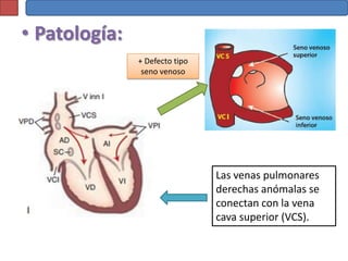 • Patología:
               + Defecto tipo
                seno venoso




                                Las venas pulmonares
                                derechas anómalas se
                                conectan con la vena
                                cava superior (VCS).
 