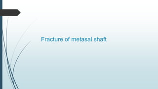 Fracture of metasal shaft
 