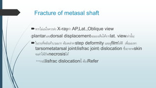 Fracture of metasal shaft
หากไม่แน่ใจควรส่ง X-rayท่า AP,Lat.,Oblique view
(plantarและdorsal displacementจะมองเห็นได้จากlat. viewเท่านั้น)
ในรายที่หลังเท้าบวมมาก ต้องคลาหาstep deformity และดูfilmให้ดี เพื่อมองหา
tarsometatarsal joint(lisfrac joint) dislocation ซึ่งอาจกดskin
จนทาให้เกิดnecrosisได้
***กรณีlisfrac dislocationนี้ ต้องRefer
 